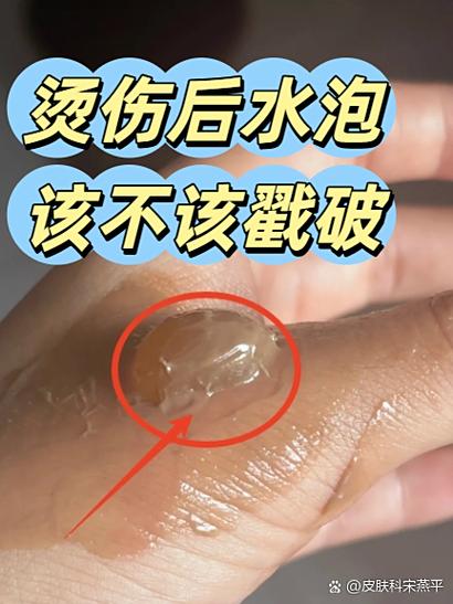 氢气球破了怎么补救缩略图