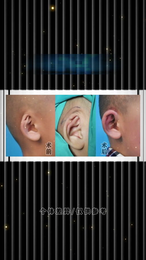 华为手机接电话旁边都能听到缩略图