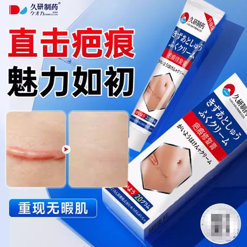 疤痕色素沉着怎么去除最快最有效