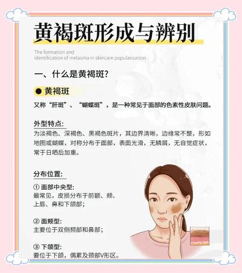 斑怎么去除最有效缩略图