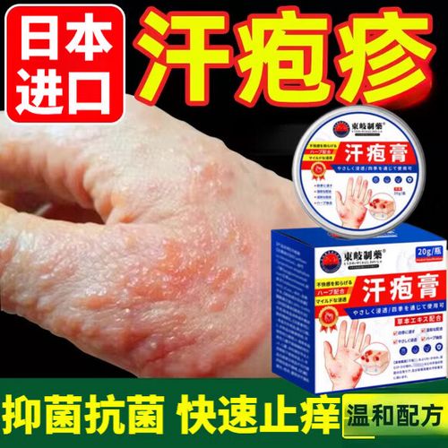 手上长水泡痒用什么药缩略图