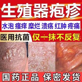 鸡把皮上起小水泡用什么药缩略图