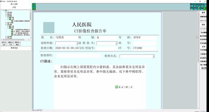 pacs是什么检查项目