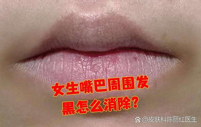女生回复emm黑嘴是什么意思缩略图