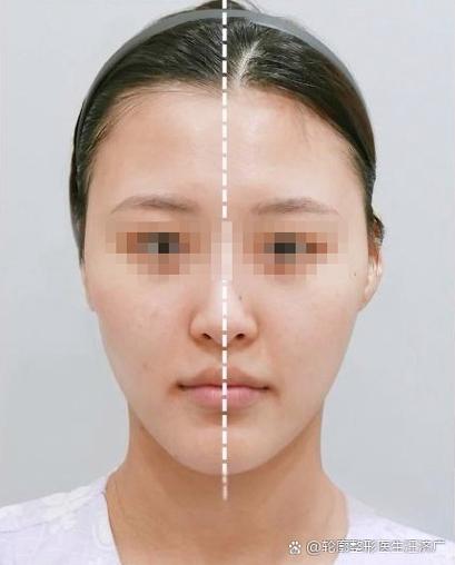 拍视频左右脸反了缩略图