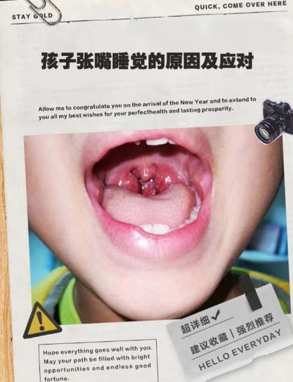 小孩经常张嘴是什么原因游戏截图