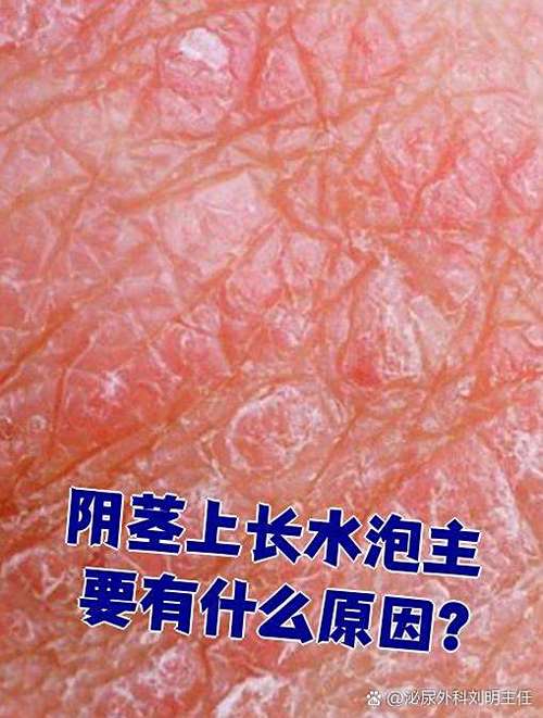 男人鸡上长小水泡是怎么回事游戏截图